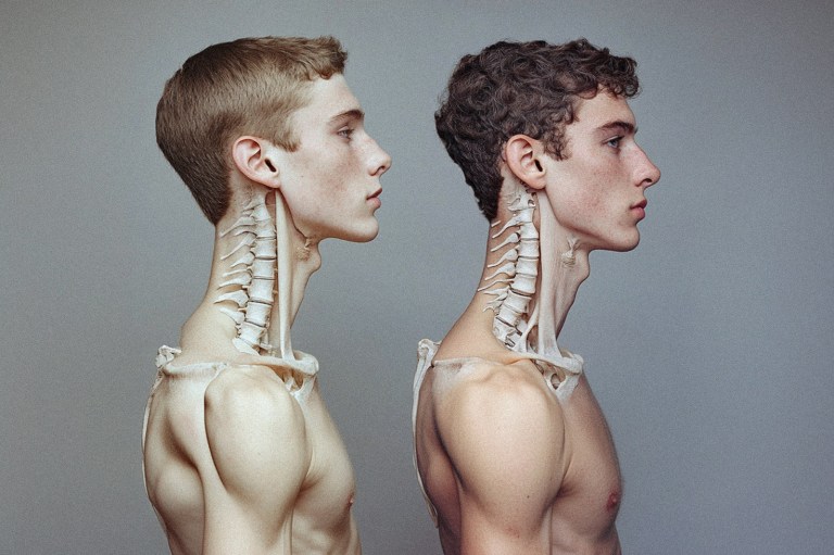 These Zodiac Signs Are Likely To Have Bad Posture
