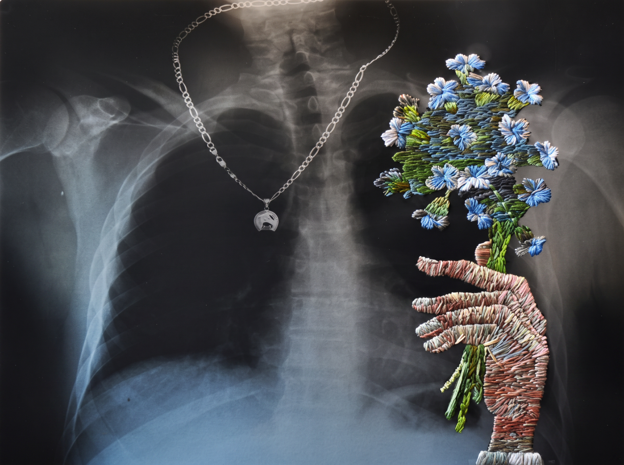 Chest X-ray with a silver necklace visible, overlaid by an embroidered hand holding a bouquet of blue flowers