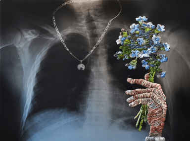 Chest X-ray with a silver necklace visible, overlaid by an embroidered hand holding a bouquet of blue flowers